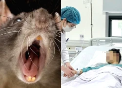 Mắc bệnh nhiễm trùng hiếm gặp sau khi bị chuột cắn