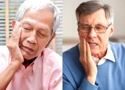 Mất răng ở người cao tuổi: Coi chừng nguy cơ suy dinh dưỡng và kiệt quệ sức khỏe