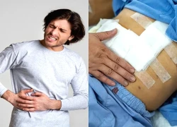 Một dấu hiệu cảnh báo sớm bệnh gan mật không nên bỏ qua