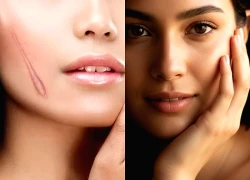 Tiết lộ cách giúp vết thương trên mặt không để lại sẹo