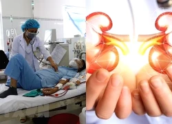 8 cách phòng ngừa bệnh thận mạn tính