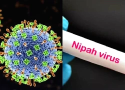 Bộ Y tế cảnh báo nguy cơ từ virus Nipah: Chưa có vắc xin, tỉ lệ tử vong cao
