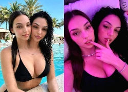 Cú lừa ngoạn mục của kỷ nguyên số: Cặp song sinh dính liền "vạn người mê" này thực chất là sản phẩm của AI