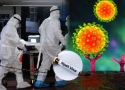 TP.HCM ra lệnh khẩn vì virus Nipah, khóa chặt cửa khẩu vì nguy hiểm hơn Covid-19?