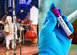 WHO, CDC nói về virus Nipah: Ai có nguy cơ, nguy hiểm đến đâu?