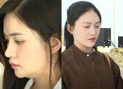 Khởi tố 15 "hot girl" trong đường dây mạo danh bác sĩ thẩm mỹ