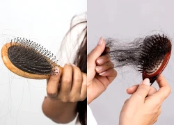 Sang thu tóc rụng nhiều: 5 cách chăm sóc tóc đơn giản giúp hạn chế gãy rụng