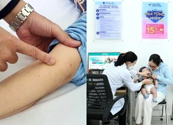 Quên loại vắc xin từng tiêm cho con: Phụ huynh bình tĩnh làm điều này