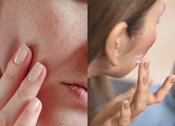 Thời tiết hanh khô, chăm sóc da thế nào để tránh khô ráp, nứt nẻ?