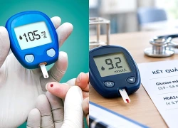Đi khám định kỳ phát hiện mắc bệnh có tỷ lệ biến chứng tới 54%