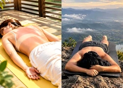 Trào lưu phơi nắng giữa trưa chữa nhiều bệnh: Chuyên gia cảnh báo nguy cơ