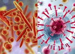 Ca tử vong do viêm phổi chưa rõ nguyên nhân ở Nga: Bộ Y tế khuyến cáo người dân điều gì?