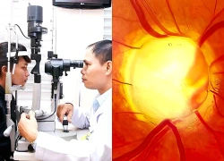 Thử nghiệm thành công phương pháp mở ra hy vọng mang lại ánh sáng cho người mù