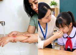 Kỹ năng sơ cứu cơ bản giáo viên và cha mẹ cần biết để bảo vệ trẻ