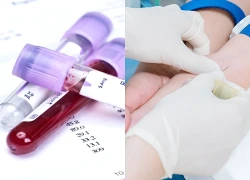 3 chỉ số gan cầu cứu khi xét nghiệm máu