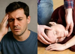 5 dấu hiệu nhận biết sớm cơn thiếu máu não thoáng qua