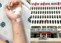 TPHCM: Phát hiện chùm ca não mô cầu, một học sinh tử vong