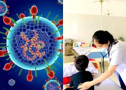 Virus RSV ở trẻ dễ lây lan, nguy cơ viêm phổi