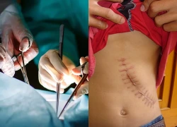 Bán thận rồi trở thành môi giới mua bán cơ thể người