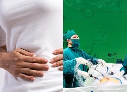 Tắc ruột sau mổ đẻ, biến chứng không thể chủ quan