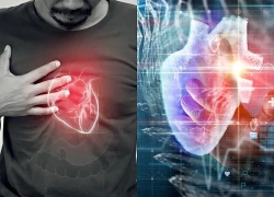 Khám phá bất ngờ: AI có thể phát hiện tín hiệu cảnh báo đột tử do tim