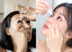 Loại thuốc không cần kê đơn mới giúp giảm đỏ mắt do kích ứng