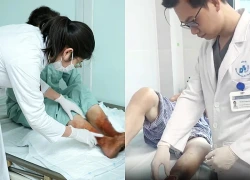Suýt trả giá đắt vì đắp lá chữa loét chân
