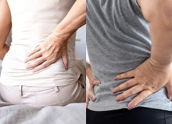 Thoát vị đĩa đệm không phải cứ mắc là phải mổ