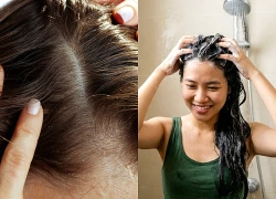 Thói quen gội đầu và chăm sóc da đầu đúng cách tại nhà