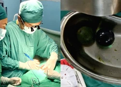 Bé gái 18 tháng tuổi nguy kịch, bác sĩ gắp ra thứ "đáng sợ" trong bụng