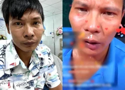 Tình trạng bất ổn của Lộc Fuho: Livestream lúc nửa đêm, thường xuyên 'mất tích'?