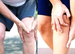 Tràn dịch khớp gối: Đừng chủ quan khi đầu gối sưng đau