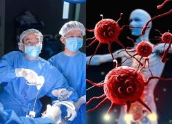 Ăn cơm có cảm giác nuốt vướng, người đàn ông sốc khi phát hiện 3 bệnh ung thư cùng lúc