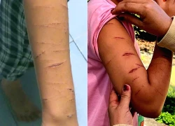 Chỉ đạo xử lý vụ học sinh lớp 5 bị chị họ dùng dao rạch nhiều lần tại Cà Mau