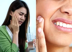 Đau nhức răng liên tục là do đâu?