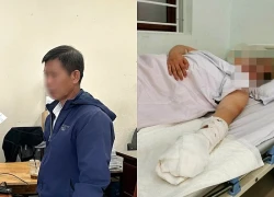 Người đàn ông bị chém đứt lìa 3 ngón tay khi đang chơi đàn trên sân khấu