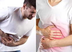 Viêm loét dạ dày dễ tái phát vào dịp cuối năm