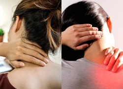 4 cách làm giảm nguy cơ đau cổ vai gáy