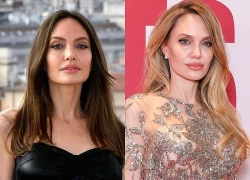 Angelina Jolie và câu chuyện vết sẹo sau phẫu thuật gây xúc động