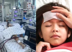 Các bệnh nhiễm siêu vi có thể biến chứng viêm cơ tim