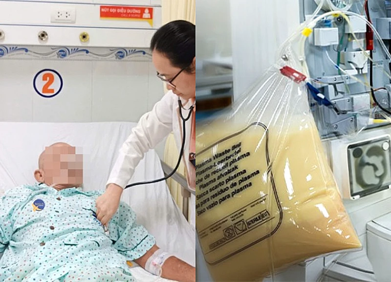 Người đàn ông nguy kịch, mỡ máu cao gấp 48 lần sau nhiều bữa tất niên thịnh soạn