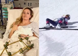Sự cố chấn động tại Thế vận hội mùa đông: "Nữ hoàng trượt tuyến" phẫu thuật lần 3 sau cú ngã kinh hoàng