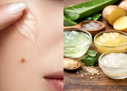 5 loại gel tự làm giúp sáng da, mờ thâm mụn