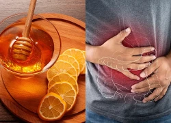 Các bệnh tiêu hóa dễ mắc mùa Đông Xuân