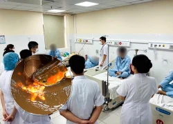 Thanh Hóa: 13 người ngộ độc vì ăn trứng một loài cá, CA vào cuộc, bác sĩ nói sốc!