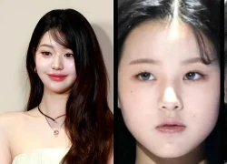 Jang Wonyoung lộ gương mặt “tượng sáp”, nghiện dao kéo quá đà, fan lo sợ hệ lụy