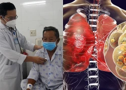 Nguy cơ viêm phổi và viêm phế quản gia tăng trong mùa đông - xuân