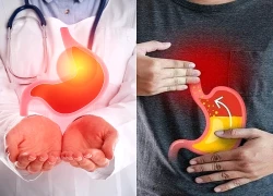 Tác hại và biến chứng của bệnh trào ngược dạ dày thực quản