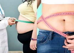 Béo phì làm tăng 70% nguy cơ nhập viện và tử vong do nhiễm trùng