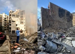 Liên hợp quốc sẵn sàng ứng phó khủng hoảng nhân đạo tại Trung Đông